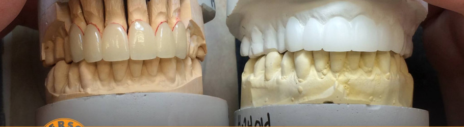 IversonDentalLabs