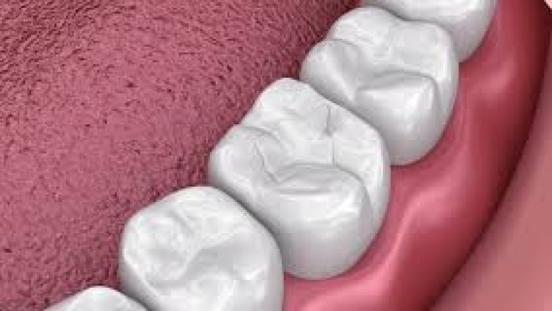 Dental Sealants Market Scope: Growth, Trends, Innovations, and Opportunities Shaping the Industry Landscape