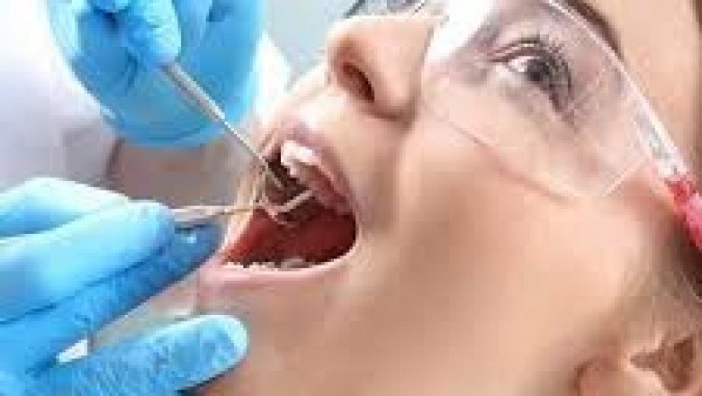 Understanding Root Canal Treatment: A Key Solution for Dental Health in Islamabad