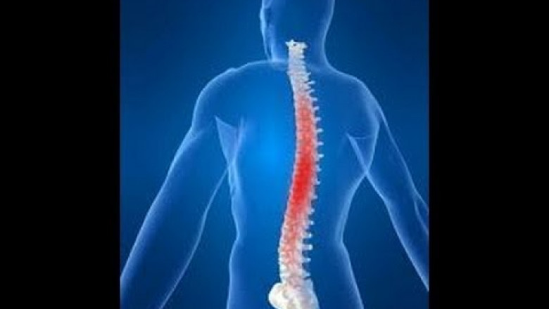 Understanding the Growth of Ankylosing Spondylitis Market owing to Increasing Prevalence of Disease