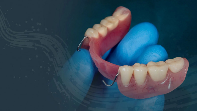 Dentures - How They Can Improve Your Smile?