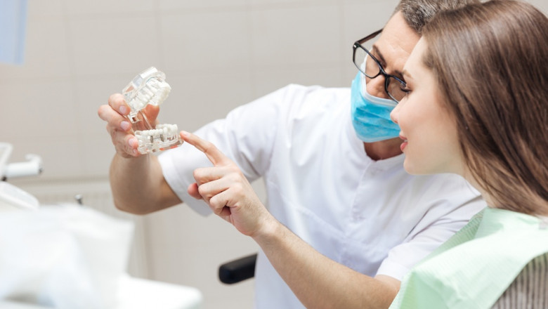 Understanding Dental Implants: Components Explained The Role of Abutments in Dental Implant Systems