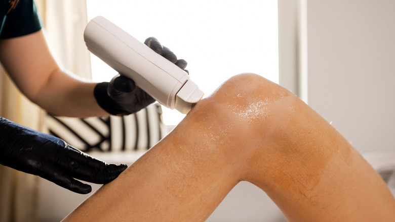 Fractional CO2 Laser Treatment: Why It’s Worth the Investment for Your Skin