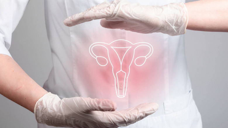 Innovations in Cervical Cancer Treatment in Kenya