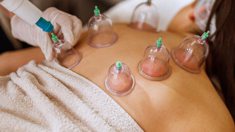 How Cupping Therapy Helps in Detoxifying the Body?