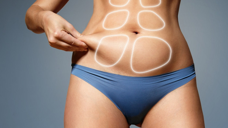 Liposuction for Lower Arm Fat in Dubai: A Comprehensive Guide