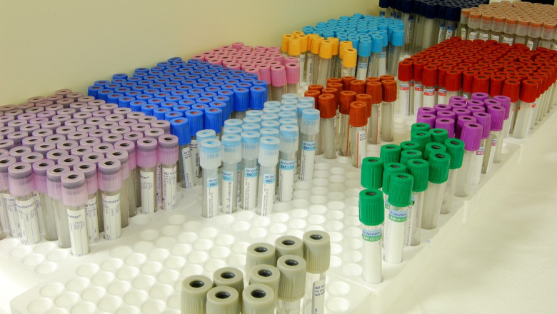 Blood Collection Tubes For Liquid Biopsy Market Analysis