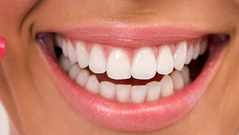 Teeth Whitening Say Hello to a Brighter You smile