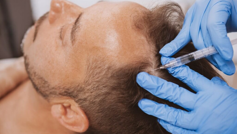 Regrow Thicker Hair with PRP Plasma Therapy