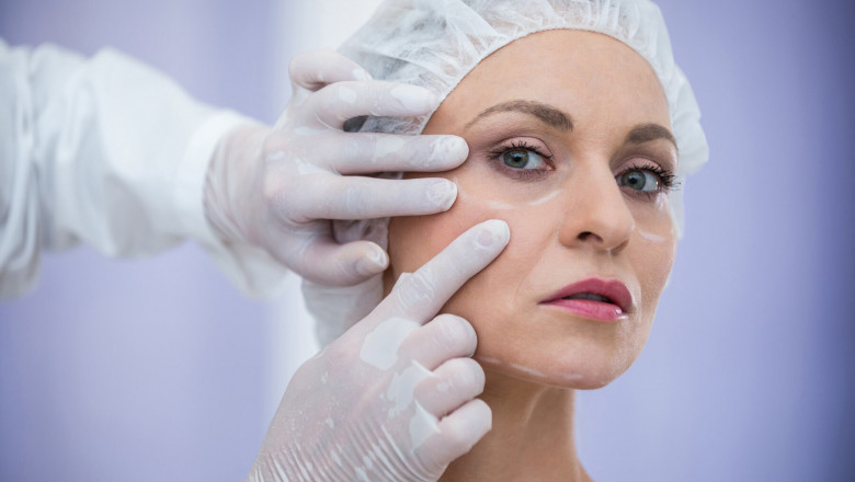 How Many Sessions Do You Need for Dark Circle Laser Treatment?