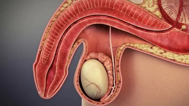 Ayurvedic Treatment for Erectile Dysfunction (ED): Balancing Body, Mind, and Sexual Health