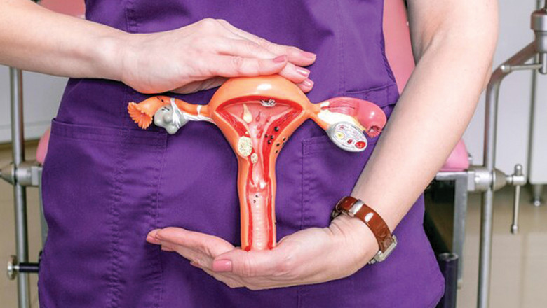 Adenomyosis and Uterine Fibroids – How Embolisation Helps