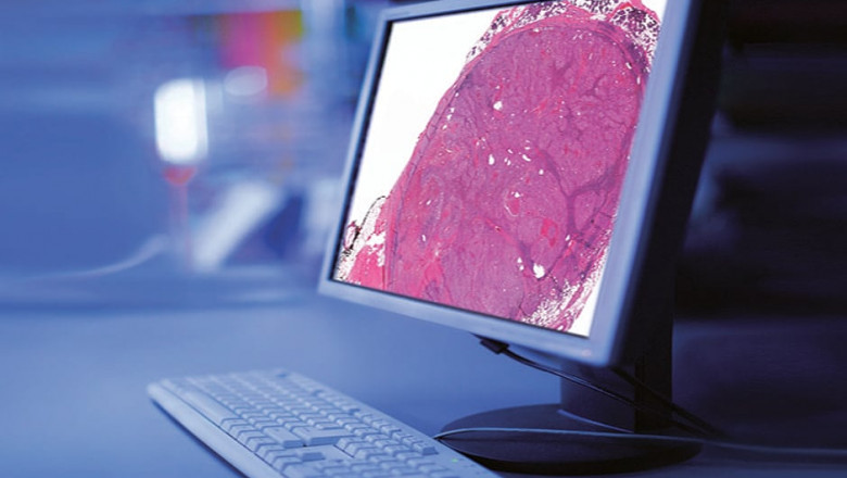 Emerging Technologies Transforming the Digital Pathology Market (2024–2034)