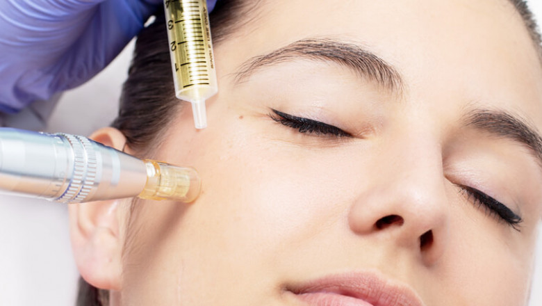 Mesotherapy Sessions in Dubai: How Pricing Works