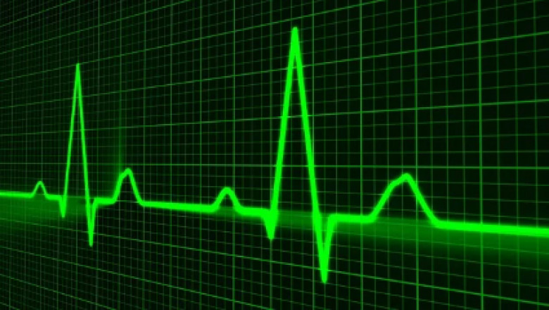 Small Signal Transistor Market