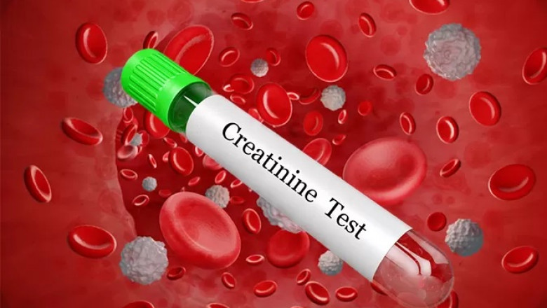 Ayurvedic Treatment for Kidney Creatinine: Holistic Approaches to Balance Creatinine Levels
