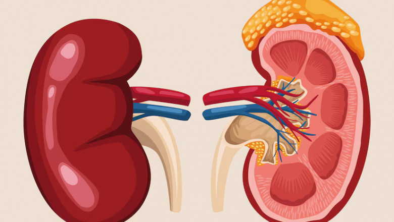 Ayurvedic Treatment for Kidney Swelling: Holistic Approaches to Relieve Swelling Naturally