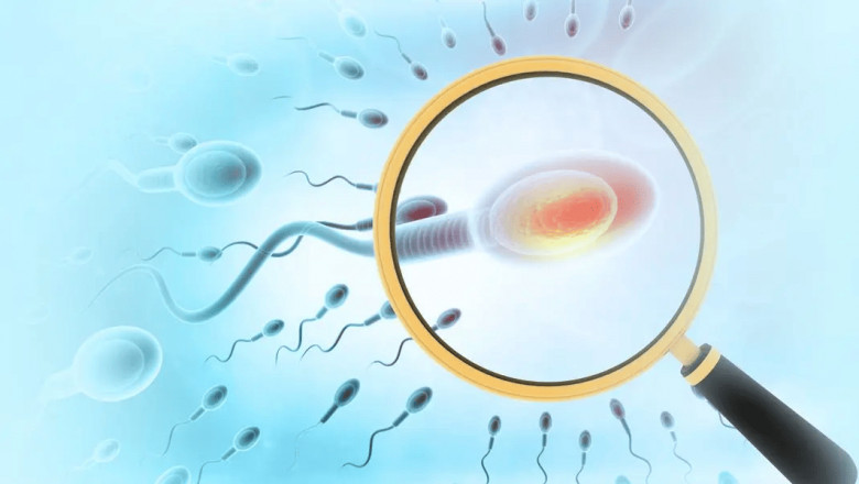 Y-chromosomal Infertility : Types, diagnosis, and treatment options