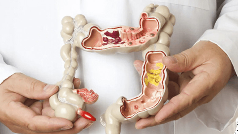 What advancements technology shaping future colorectal surgery mumbai?