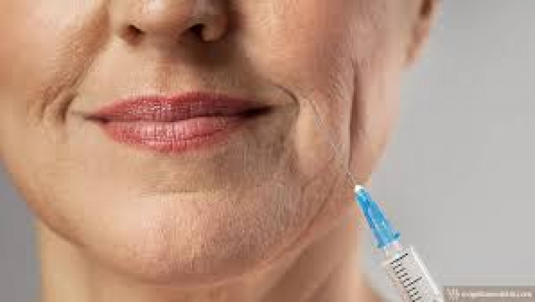 Botox, A Fast, Safe Way to Smooth Out Wrinkles