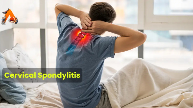 Cervical Spondylitis: Causes, Symptoms & Treatment