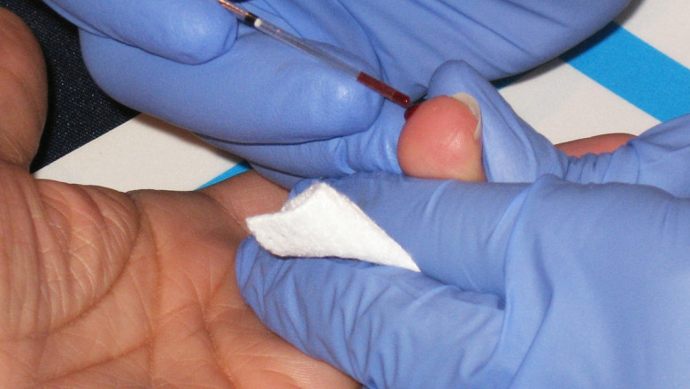 Discover the Ease of Getting a Blood Test at Home