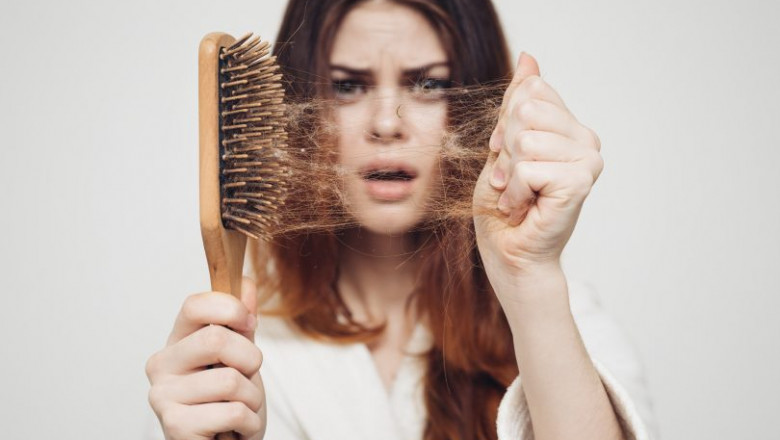 Get Your Dream Hair Back with Hair Loss Treatment Experts