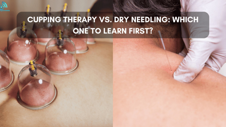 Cupping Therapy vs. Dry Needling: Which One to Learn First?