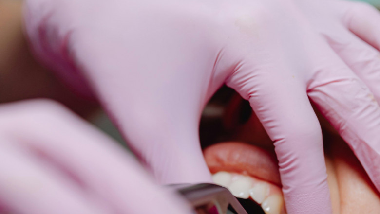 Family Dentist in Milton, ON - Hawthorne Village Dental Care