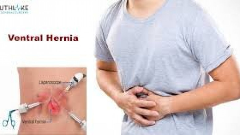 Global Ventral Hernia Treatment Market: Innovations Driving Growth and Patient Outcomes