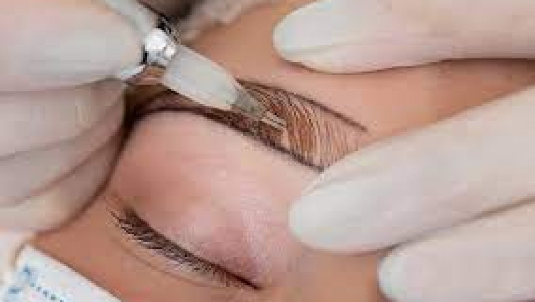 Eyebrow Hair Restoration for Men & Women