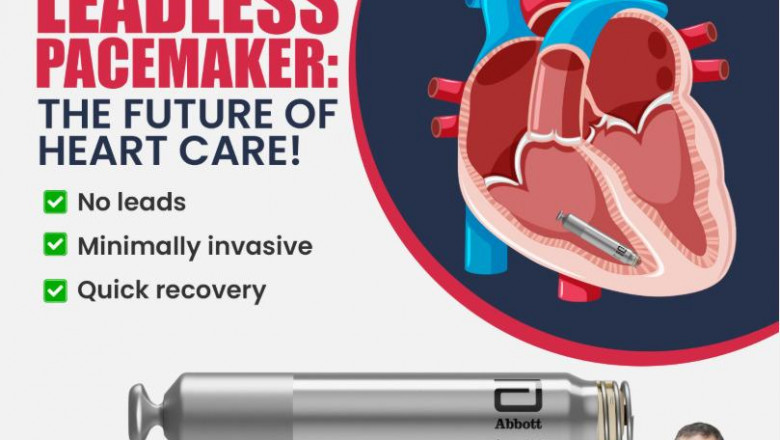 Pacemaker Implant Surgery in Delhi: Your Complete Guide to Procedure, Recovery, and Expert Care