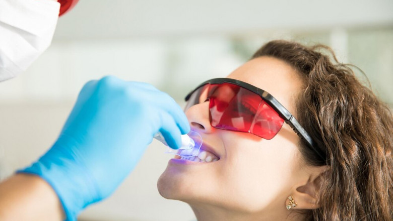 Why Dental Sealants Are Essential for Children's Oral Health