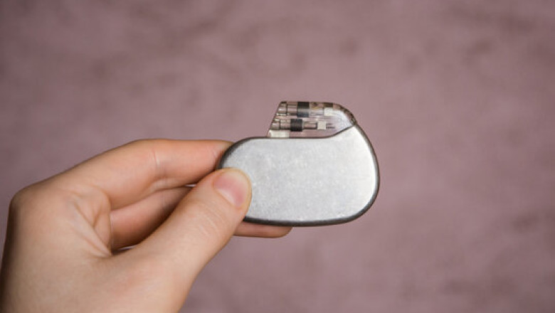 Cardiac Pacemaker Market Forecasting Significant Growth with Advancements in Device Technologies and Treatments