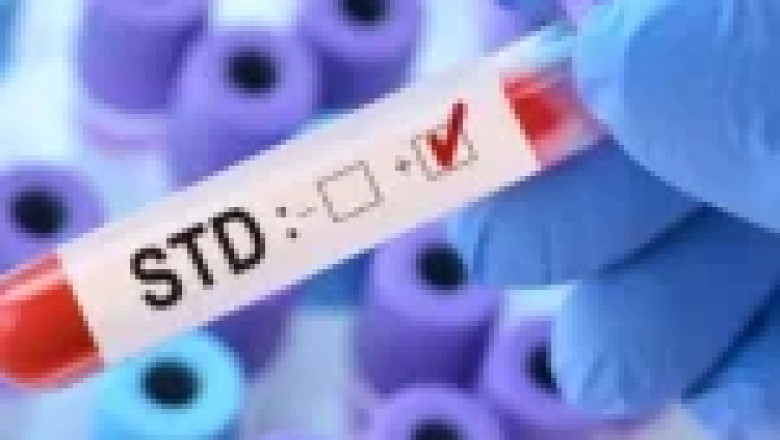 Everything to know about the importance of std testing