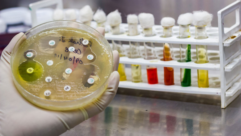 Antimicrobial Susceptibility Test Market Scenario: Pharmaceutical R&D Investments Supporting Market Innovation and Product Development