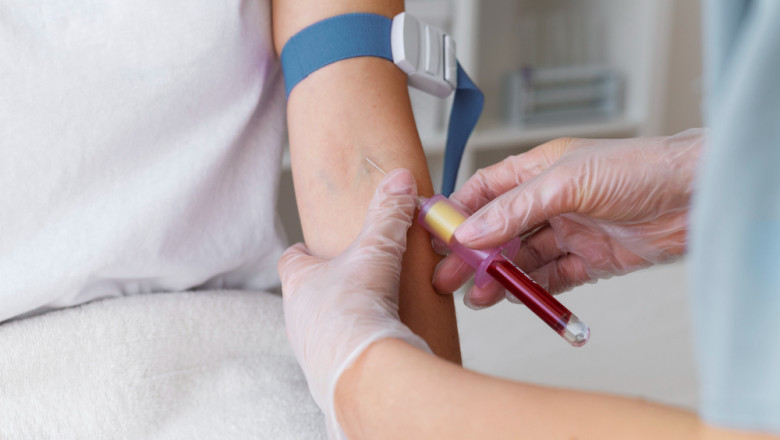 Hemophilia B: Understanding the Growing Market and Emerging Therapies