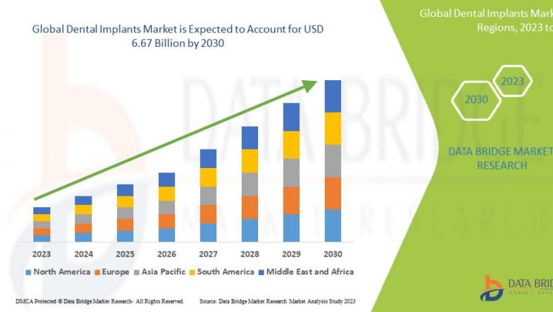 Next-Gen Dental Implants Revolutionize Patient Outcomes, Fueling Market Expansion
