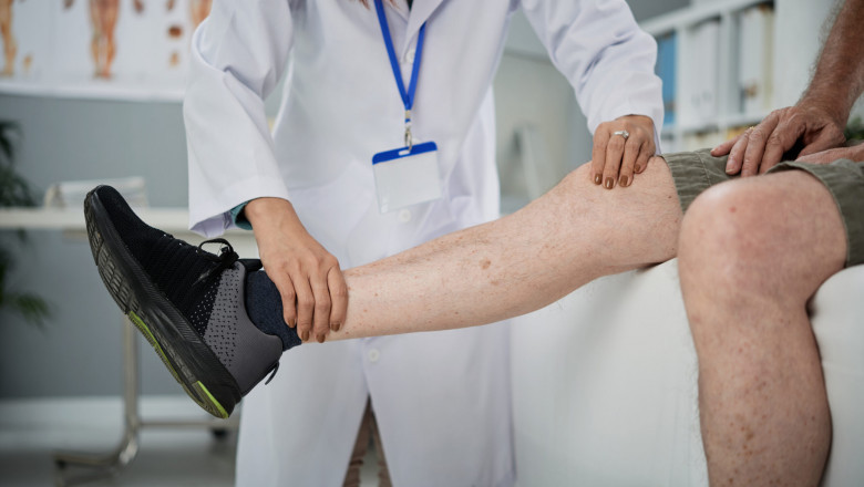 The Ultimate Guide to Workouts for Varicose Veins