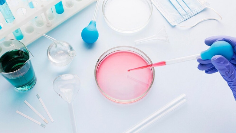 Vietnam In Vitro Diagnostics Market Size, Share, Industry Trends, Growth and Report 2025-2033
