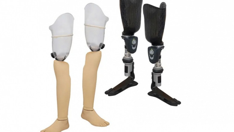 Veterinary Orthotics-Prosthetics Market Performance Boosted by Expansion of Online Platforms Offering Customized Solutions