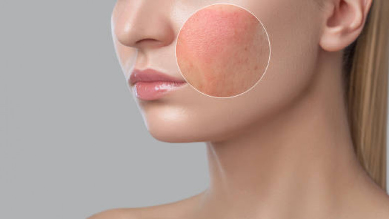 Understanding the Science Behind Sun Tan and Its Removal