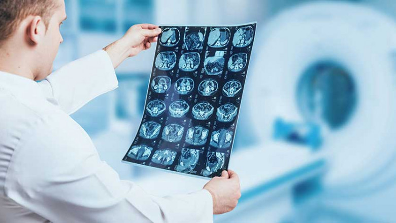 India Diagnostic Imaging Market Outlook, Share | Industry Trends 2025-2033
