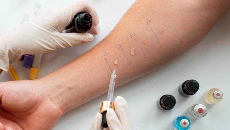 Allergy Diagnostics Market: Factors Behind Market’s Expeditious Growth 2025-2032