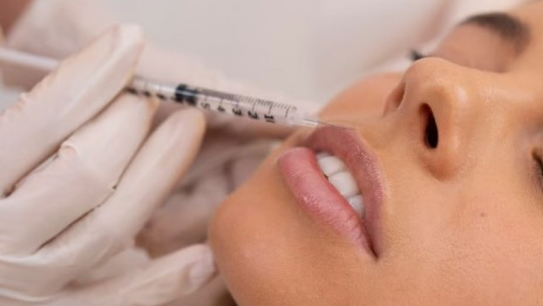 Cosmetic Doctor Melbourne – Trusted Beauty Solutions by Professionals