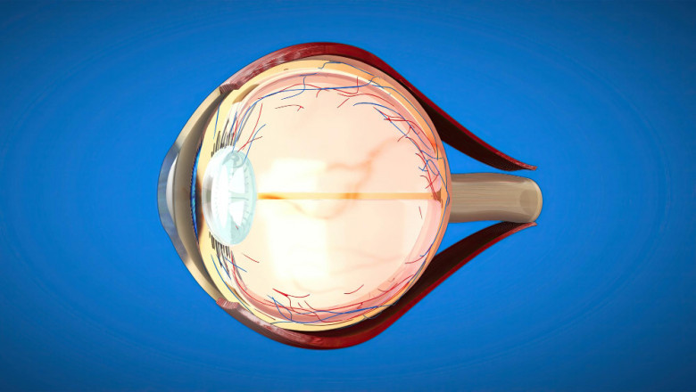 Discover the Best Retina Hospital in Chandigarh: Grover Eye Laser Hospital