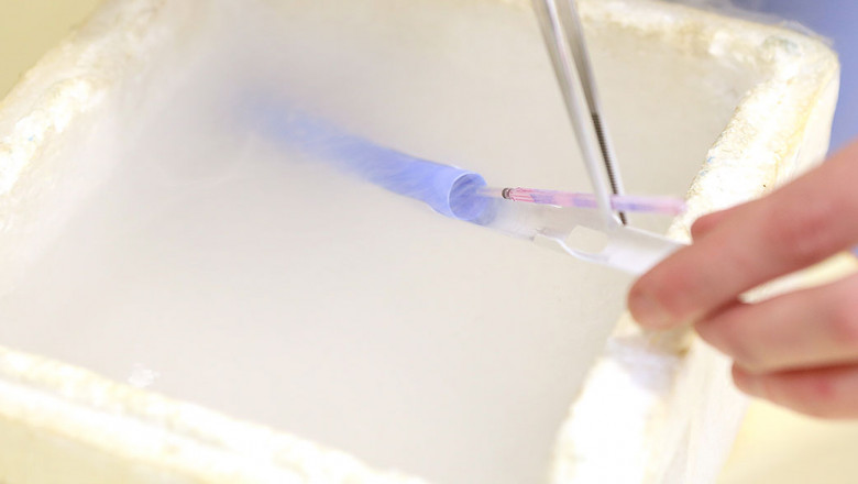 Exploring Fertility Preservation Techniques - Egg, Embryo and Sperm Freezing