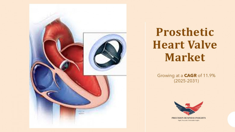 Prosthetic Heart Valve Market Size, Trends, Growth Forecast 2031