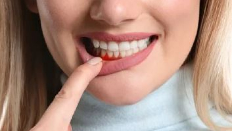 Understanding Dental Implant Cost Near Me Flint MI