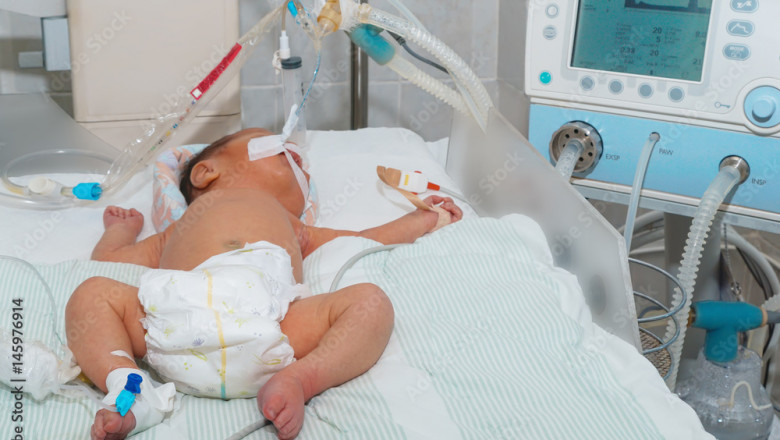 Neonatal Monitoring Equipment Market Set to Transform Healthcare with Innovative Technologies and Solutions